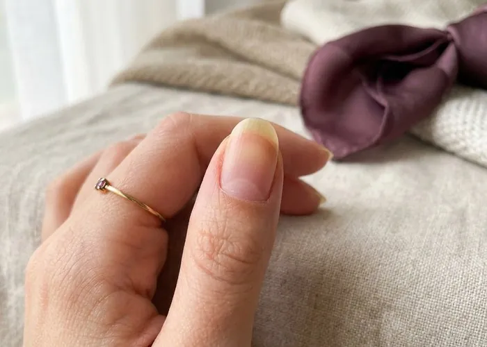 Macro close-up of a fingernail transitioning from slightly yellowed at the base to natural healthy pink at the tip