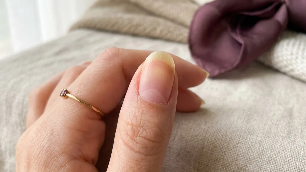 Macro close-up of a fingernail transitioning from slightly yellowed at the base to natural healthy pink at the tip