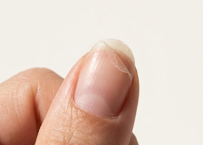 Macro of a peeling nail layer separating gently at the tip against a neutral background